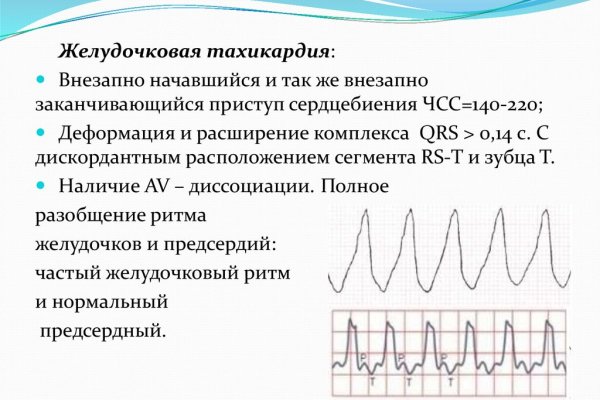 Кракен перестал работать