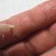 Почему появились трещины на ногтях рук — фото, причины и лечение